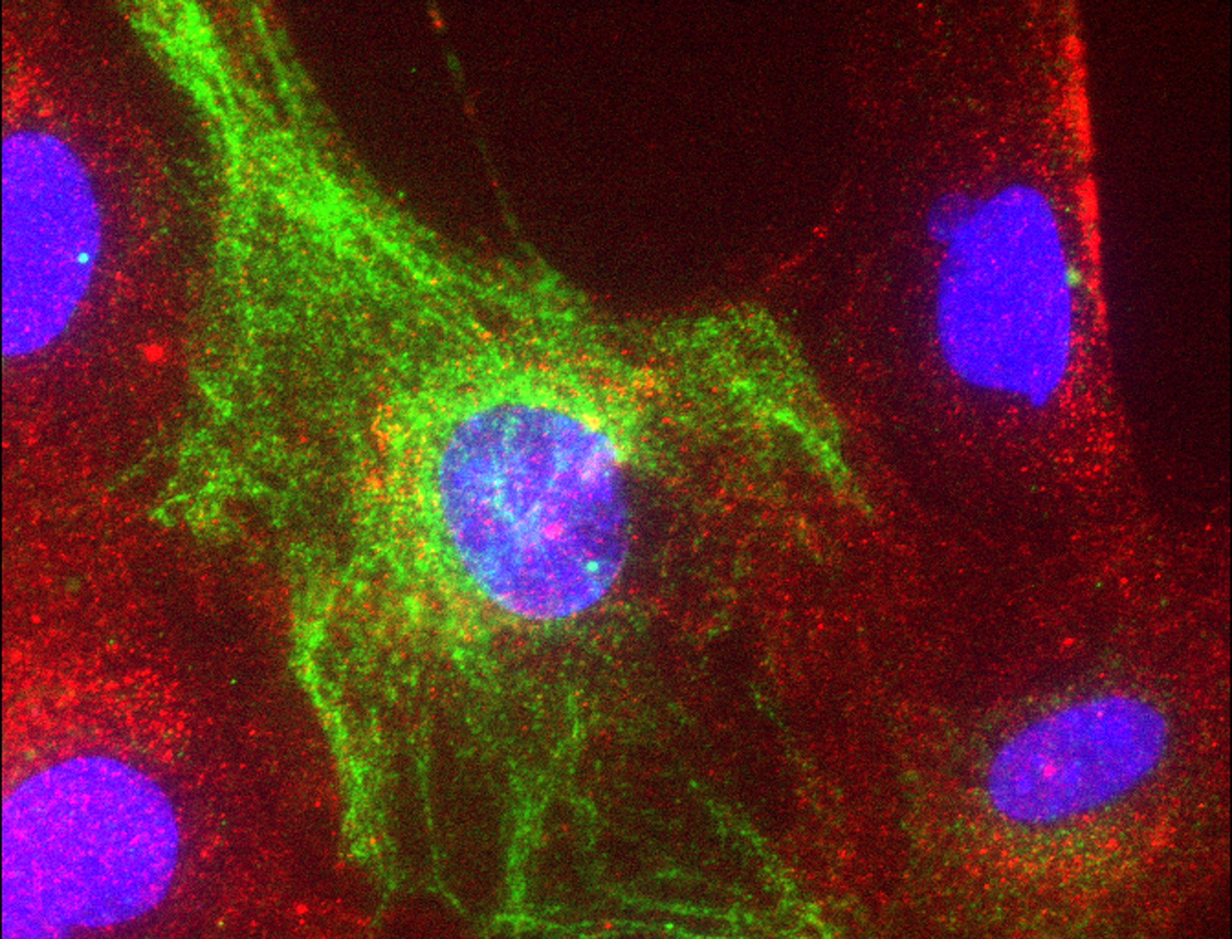 Cells developed by the Capecchi lab. Red areas represent the ews-at  fusion gene, that initiates the process leading to Clear Cell Sarcoma tumors. Green areas represent Nestin, a stem cell marker.