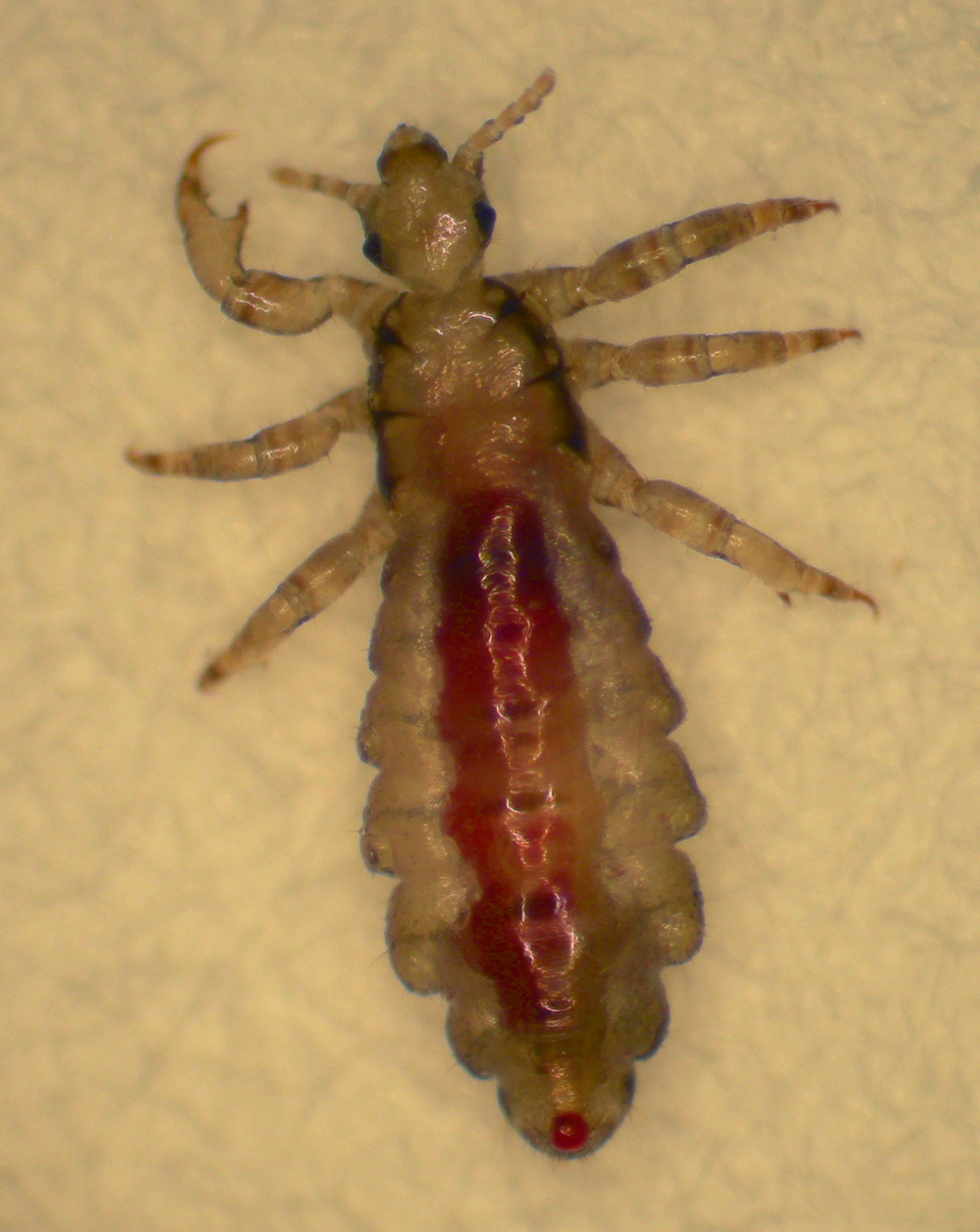 A blood-engorged head louse of the sort that plagues many children and their families. University of Utah biologists developed chemical-free, warm-air device called the LouseBuster, which kills hatched lice and their eggs, according to a new study. The LouseBuster now is on the market after gaining government clearance.