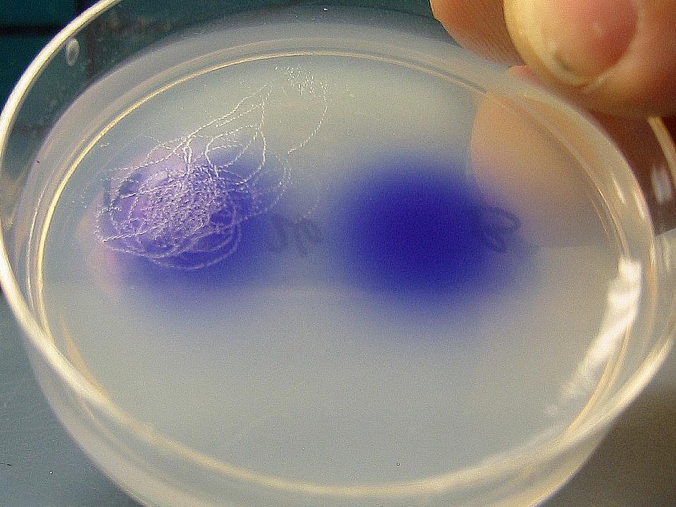 The blue spot on the left contains sexual attractants from nematode worms that are hermaphrodites, or have male and female organs. The blue spot on the right does not. The photo shows the results of a University of Utah experiment in which the brains of hermaphrodite worms were masculinized so they showed same-sex attraction to other hermaphrodites. The tracks of masculinized hermaphrodites cover the blue spot on the left because the worms were attracted to the odor of other hermaphrodites.