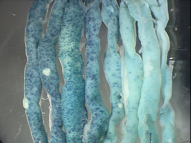 This magnified image of a mouse intestine that has been laid out back and forth, with the upper end of the intestine at the left and the lower end at the right. Adult intestinal stem cells, labeled with blue dye attached to a gene named Bmi1, are responsible for creating and maintaining other kinds of cells that line the intestine. It is apparent adult stem cells are most common in the upper intestine at left and less abundant in the middle and lower intestine, center and right. That suggests there may be more than one type of adult stem cell operating in the intestine and perhaps in other organs, complicating efforts to use the cells to treat disease, according to a University of Utah study.