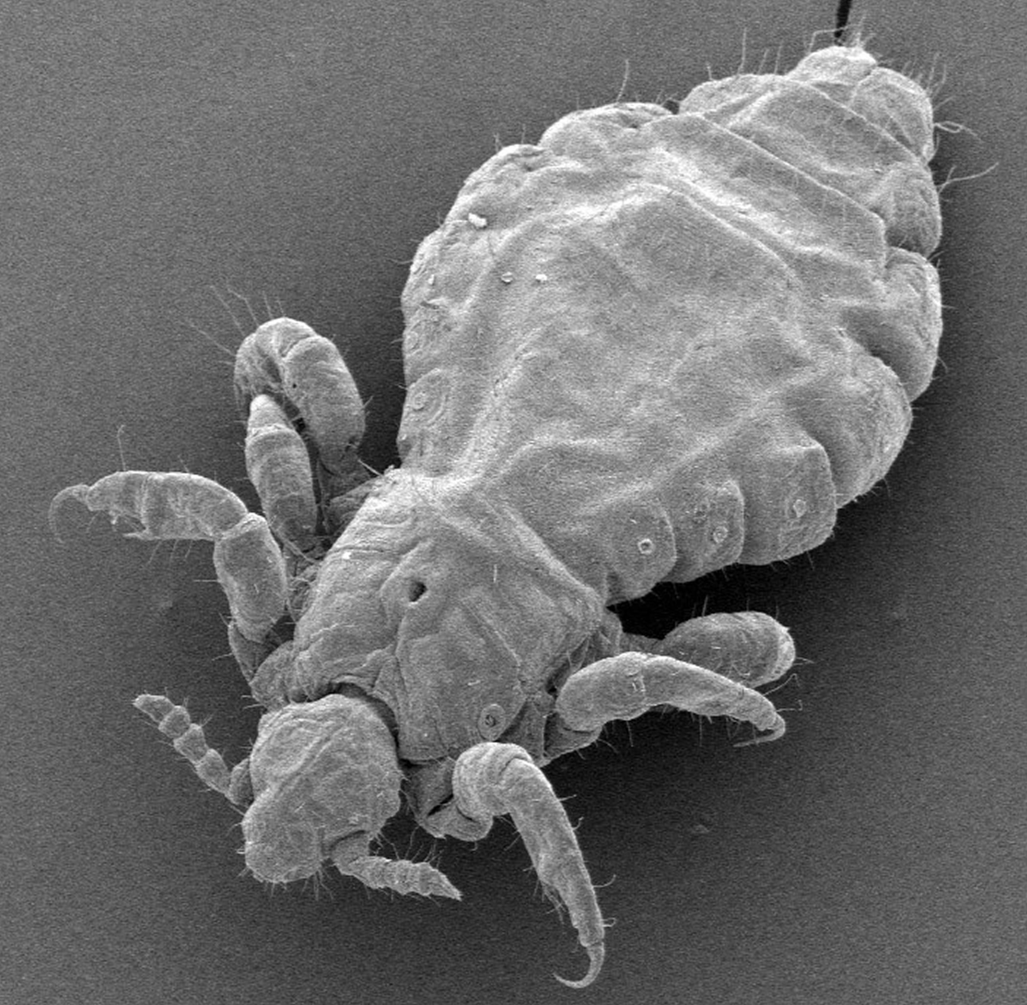 Scanning electron microscope image of a modern human head louse, Pediculus humanus.