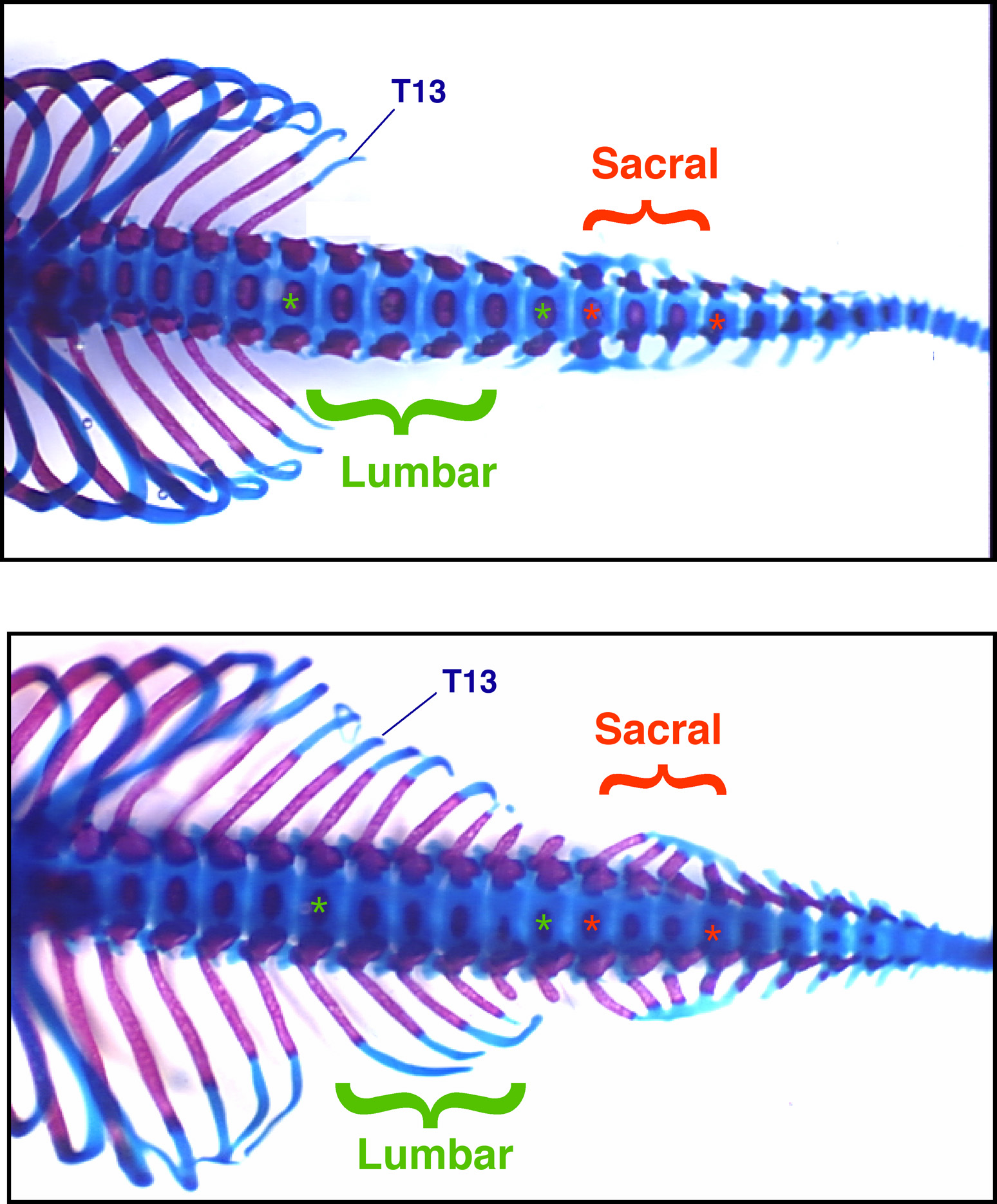 Top photo shows the back half of a normal mouse skeleton. Note the ribs end at T13, the 13th thoracic or chest vertebra. The lumbar (lower back) and sacral (pelvic) vertebrae form normally. But when Hox10 genes are disabled, as shown in bottom photo, ribs grow from vertebrae all the way from the chest to the tail.